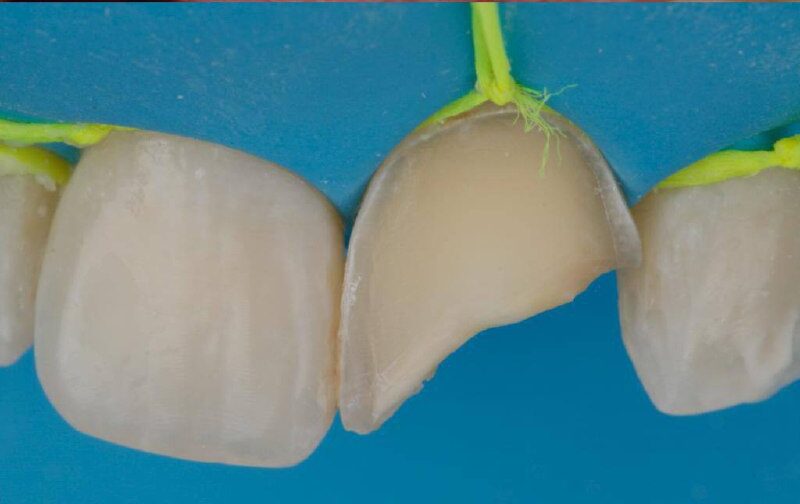 photo_5167959750585986293_x