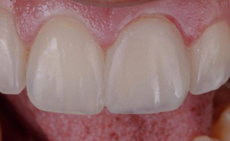 photo_5167959750585986294_x